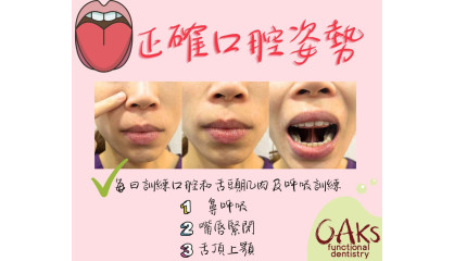 什麼是正確的口腔姿勢？